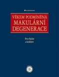 Věkem podmíněná makulární degenerace