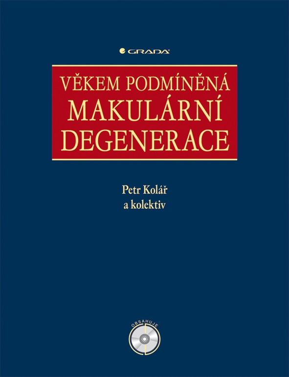 Věkem podmíněná makulární degenerace